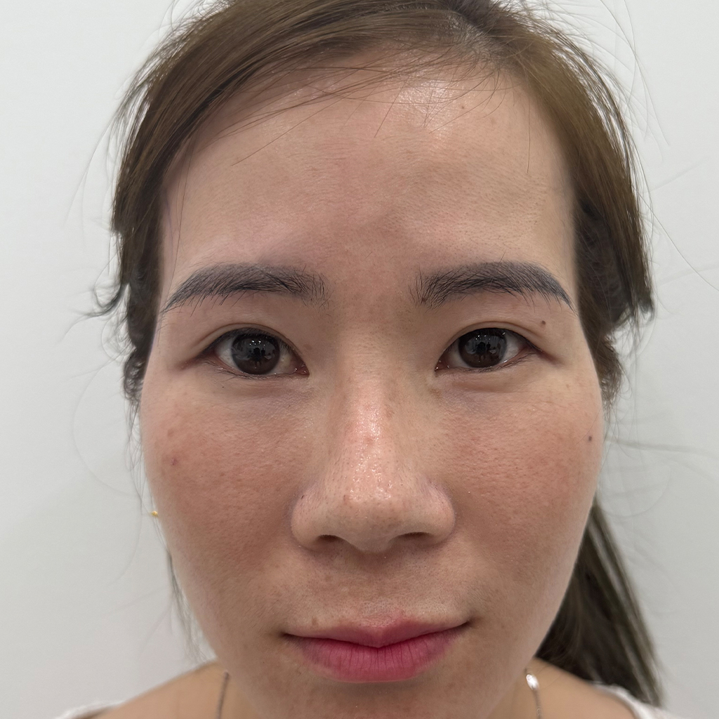Before