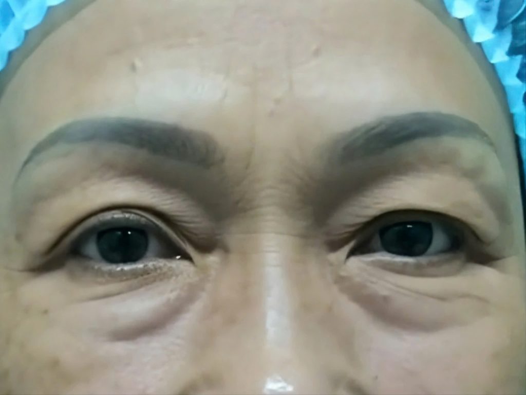 Nang cung chan may (truoc)