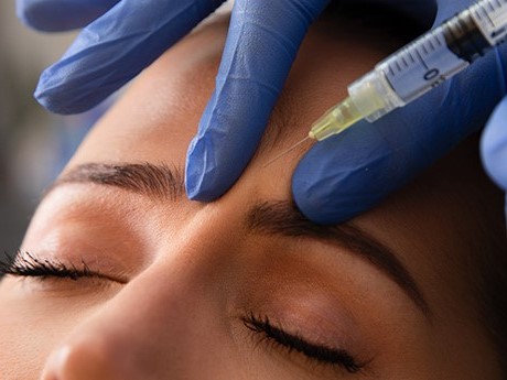 Tiêm botox xóa nếp nhăn