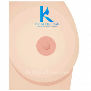 Kích thước quầng cần phù hợp với size ngực để trong hài hòa và đẹp hơn