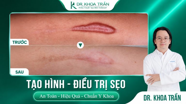 Cắt sẹo xấu — Khi nào nên can thiệp phẫu thuật