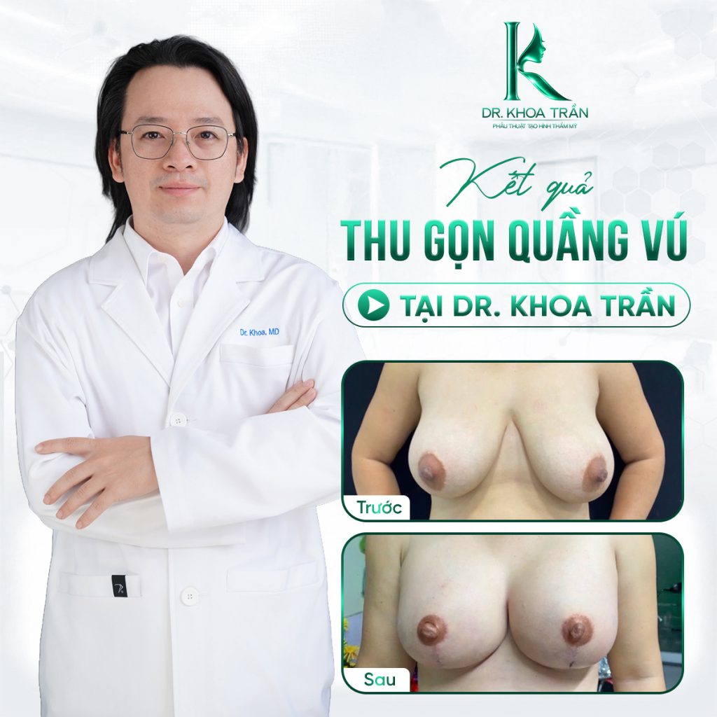 Hình ảnh trước và sau thu nhỏ quầng vú