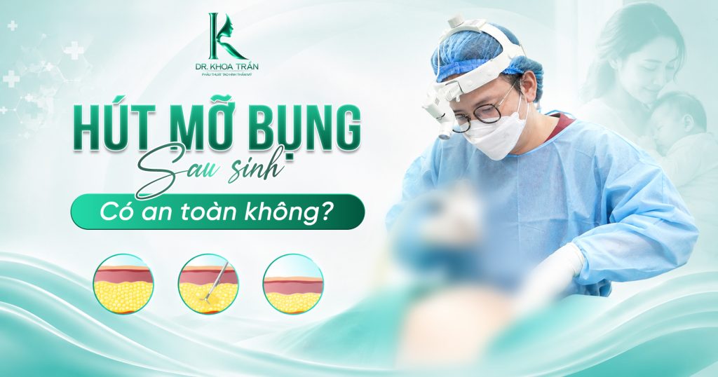 Hút mỡ bụng sau sinh có an toàn không