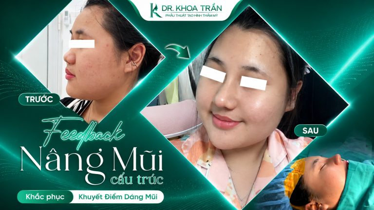 Nâng Mũi Thẩm Mỹ: Hướng Dẫn Từ A-Z Cho Người Mới